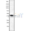 Western blot analysis of V-ATPase D1 using HeLa whole cell lysates