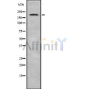 Western blot analysis of ZFP106 using HeLa whole cell lysates