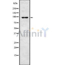 Western blot analysis of ZFP598 using COLO205 whole cell lysates