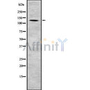 Western blot analysis of ZO-2 using Jurkat whole cell lysates