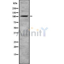 DF8633 staining 293 cells by IF/ICC. The sample were fixed with PFA and permeabilized in 0.1% Triton X-100,then blocked in 10% serum for 45 minutes at 25¡ãC. The primary antibody was diluted at 1/200 and incubated with the sample for 1 hour at 37¡ãC. An  Alexa Fluor 594 conjugated goat anti-rabbit IgG (H+L) antibody(Cat.