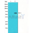 DF8634 staining HepG2 cells by IF/ICC. The sample were fixed with PFA and permeabilized in 0.1% Triton X-100,then blocked in 10% serum for 45 minutes at 25¡ãC. The primary antibody was diluted at 1/200 and incubated with the sample for 1 hour at 37¡ãC. An  Alexa Fluor 594 conjugated goat anti-rabbit IgG (H+L) antibody(Cat.