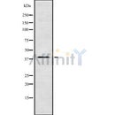 DF8636 staining Hela cells by IF/ICC. The sample were fixed with PFA and permeabilized in 0.1% Triton X-100,then blocked in 10% serum for 45 minutes at 25¡ãC. The primary antibody was diluted at 1/200 and incubated with the sample for 1 hour at 37¡ãC. An  Alexa Fluor 594 conjugated goat anti-rabbit IgG (H+L) antibody(Cat.