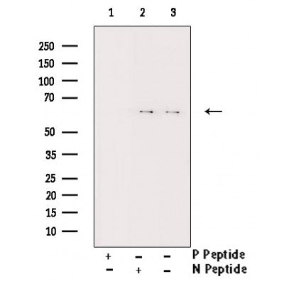 AF3034 staining 293 by IF/ICC. The sample were fixed with PFA and permeabilized in 0.1% Triton X-100,then blocked in 10% serum for 45 minutes at 25¡ãC. The primary antibody was diluted at 1/200 and incubated with the sample for 1 hour at 37¡ãC. An  Alexa Fluor 594 conjugated goat anti-rabbit IgG (H+L) Ab, diluted at 1/600, was used as the secondary antibod