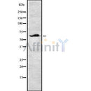 DF8638 staining Hela cells by IF/ICC. The sample were fixed with PFA and permeabilized in 0.1% Triton X-100,then blocked in 10% serum for 45 minutes at 25¡ãC. The primary antibody was diluted at 1/200 and incubated with the sample for 1 hour at 37¡ãC. An  Alexa Fluor 594 conjugated goat anti-rabbit IgG (H+L) antibody(Cat.