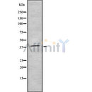 Western blot analysis of AurB/C using Jurkat whole cell lysates