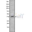 Western blot analysis of extracts from Rat brain, using AWAT1 Antibody.