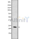 DF8641 staining Hela by IF/ICC. The sample were fixed with PFA and permeabilized in 0.1% Triton X-100,then blocked in 10% serum for 45 minutes at 25¡ãC. The primary antibody was diluted at 1/200 and incubated with the sample for 1 hour at 37¡ãC. An  Alexa Fluor 594 conjugated goat anti-rabbit IgG (H+L) Ab, diluted at 1/600, was used as the secondary antibod