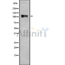 Western blot analysis of extracts from EL4 cells, using CARD10 Antibody. The lane on the left was treated with blocking peptide.