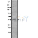 DF8643 staining HepG2 by IF/ICC. The sample were fixed with PFA and permeabilized in 0.1% Triton X-100,then blocked in 10% serum for 45 minutes at 25¡ãC. The primary antibody was diluted at 1/200 and incubated with the sample for 1 hour at 37¡ãC. An  Alexa Fluor 594 conjugated goat anti-rabbit IgG (H+L) Ab, diluted at 1/600, was used as the secondary antibod