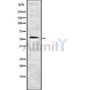 DF8645 staining LOVO by IF/ICC. The sample were fixed with PFA and permeabilized in 0.1% Triton X-100,then blocked in 10% serum for 45 minutes at 25¡ãC. The primary antibody was diluted at 1/200 and incubated with the sample for 1 hour at 37¡ãC. An  Alexa Fluor 594 conjugated goat anti-rabbit IgG (H+L) Ab, diluted at 1/600, was used as the secondary antibod