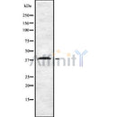 Western blot analysis of extracts from HepG2, using CNR2 Antibody. The lane on the left was treated with blocking peptide.