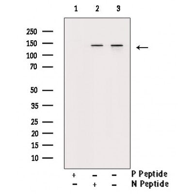 Western blot analysis of extracts from HepG2, using Phospho-Abl (Tyr204) Antibody. Lane 1 was treated with the blocking peptide.