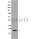 Western blot analysis of extracts of various tissue sample,using Cofilin  Antibody .