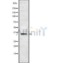 DF8651 staining Hela cells by IF/ICC. The sample were fixed with PFA and permeabilized in 0.1% Triton X-100,then blocked in 10% serum for 45 minutes at 25¡ãC. The primary antibody was diluted at 1/200 and incubated with the sample for 1 hour at 37¡ãC. An  Alexa Fluor 594 conjugated goat anti-rabbit IgG (H+L) antibody(Cat.