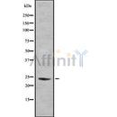 DF8652 staining LOVO cells by IF/ICC. The sample were fixed with PFA and permeabilized in 0.1% Triton X-100,then blocked in 10% serum for 45 minutes at 25¡ãC. The primary antibody was diluted at 1/200 and incubated with the sample for 1 hour at 37¡ãC. An  Alexa Fluor 594 conjugated goat anti-rabbit IgG (H+L) antibody(Cat.