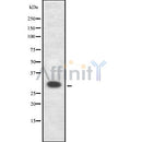 DF8654 staining LOVO by IF/ICC. The sample were fixed with PFA and permeabilized in 0.1% Triton X-100,then blocked in 10% serum for 45 minutes at 25¡ãC. The primary antibody was diluted at 1/200 and incubated with the sample for 1 hour at 37¡ãC. An  Alexa Fluor 594 conjugated goat anti-rabbit IgG (H+L) Ab, diluted at 1/600, was used as the secondary antibod