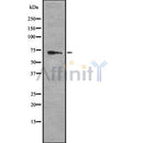 DF8655 staining  HepG2 cells by IF/ICC. The sample were fixed with PFA and permeabilized in 0.1% Triton X-100,then blocked in 10% serum for 45 minutes at 25¡ãC. The primary antibody was diluted at 1/200 and incubated with the sample for 1 hour at 37¡ãC. An  Alexa Fluor 594 conjugated goat anti-rabbit IgG (H+L) antibody(Cat.