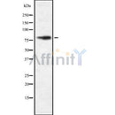 DF8656 staining HuvEc by IF/ICC. The sample were fixed with PFA and permeabilized in 0.1% Triton X-100,then blocked in 10% serum for 45 minutes at 25¡ãC. The primary antibody was diluted at 1/200 and incubated with the sample for 1 hour at 37¡ãC. An  Alexa Fluor 594 conjugated goat anti-rabbit IgG (H+L) Ab, diluted at 1/600, was used as the secondary antibod