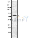 DF8657 staining  HT29 cells by IF/ICC. The sample were fixed with PFA and permeabilized in 0.1% Triton X-100,then blocked in 10% serum for 45 minutes at 25¡ãC. The primary antibody was diluted at 1/200 and incubated with the sample for 1 hour at 37¡ãC. An  Alexa Fluor 594 conjugated goat anti-rabbit IgG (H+L) antibody(Cat.