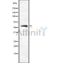 Western blot analysis FZD8 using COLO205 whole cell lysates