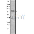 DF8660 at 1/100 staining Human prostate tissue by IHC-P. The sample was formaldehyde fixed and a heat mediated antigen retrieval step in citrate buffer was performed. The sample was then blocked and incubated with the antibody for 1.5 hours at 22¡ãC. An HRP conjugated goat anti-rabbit antibody was used as the secondary
