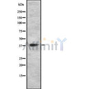DF8662 staining 293 by IF/ICC. The sample were fixed with PFA and permeabilized in 0.1% Triton X-100,then blocked in 10% serum for 45 minutes at 25¡ãC. The primary antibody was diluted at 1/200 and incubated with the sample for 1 hour at 37¡ãC. An  Alexa Fluor 594 conjugated goat anti-rabbit IgG (H+L) Ab, diluted at 1/600, was used as the secondary antibod