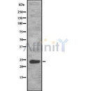 DF8664 staining MCF7 by IF/ICC. The sample were fixed with PFA and permeabilized in 0.1% Triton X-100,then blocked in 10% serum for 45 minutes at 25¡ãC. The primary antibody was diluted at 1/200 and incubated with the sample for 1 hour at 37¡ãC. An  Alexa Fluor 594 conjugated goat anti-rabbit IgG (H+L) Ab, diluted at 1/600, was used as the secondary antibod