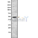 Western blot analysis of hnRNP H using Jurkat whole cell lysates