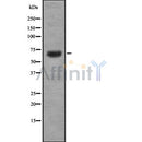 DF8668 staining  LOVO cells by IF/ICC. The sample were fixed with PFA and permeabilized in 0.1% Triton X-100,then blocked in 10% serum for 45 minutes at 25¡ãC. The primary antibody was diluted at 1/200 and incubated with the sample for 1 hour at 37¡ãC. An  Alexa Fluor 594 conjugated goat anti-rabbit IgG (H+L) antibody(Cat.