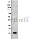 DF8670 staining Hela cells by IF/ICC. The sample were fixed with PFA and permeabilized in 0.1% Triton X-100,then blocked in 10% serum for 45 minutes at 25¡ãC. The primary antibody was diluted at 1/200 and incubated with the sample for 1 hour at 37¡ãC. An  Alexa Fluor 594 conjugated goat anti-rabbit IgG (H+L) antibody(Cat.