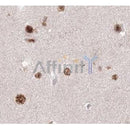 DF8671 staining  293 cells by IF/ICC. The sample were fixed with PFA and permeabilized in 0.1% Triton X-100,then blocked in 10% serum for 45 minutes at 25¡ãC. The primary antibody was diluted at 1/200 and incubated with the sample for 1 hour at 37¡ãC. An  Alexa Fluor 594 conjugated goat anti-rabbit IgG (H+L) antibody(Cat.