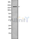 DF8673 staining RAW264.7 cells by IF/ICC. The sample were fixed with PFA and permeabilized in 0.1% Triton X-100,then blocked in 10% serum for 45 minutes at 25¡ãC. The primary antibody was diluted at 1/200 and incubated with the sample for 1 hour at 37¡ãC. An  Alexa Fluor 594 conjugated goat anti-rabbit IgG (H+L) antibody(Cat.