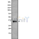 DF8674 at 1/100 staining Human prostate tissue by IHC-P. The sample was formaldehyde fixed and a heat mediated antigen retrieval step in citrate buffer was performed. The sample was then blocked and incubated with the antibody for 1.5 hours at 22¡ãC. An HRP conjugated goat anti-rabbit antibody was used as the secondary