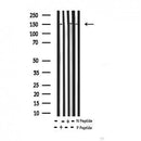 AF3041 staining SK-OV3 by IF/ICC. The sample were fixed with PFA and permeabilized in 0.1% Triton X-100,then blocked in 10% serum for 45 minutes at 25¡ãC. The primary antibody was diluted at 1/200 and incubated with the sample for 1 hour at 37¡ãC. An  Alexa Fluor 594 conjugated goat anti-rabbit IgG (H+L) Ab, diluted at 1/600, was used as the secondary antibod