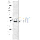 DF8678 staining HuvEc by IF/ICC. The sample were fixed with PFA and permeabilized in 0.1% Triton X-100,then blocked in 10% serum for 45 minutes at 25¡ãC. The primary antibody was diluted at 1/200 and incubated with the sample for 1 hour at 37¡ãC. An  Alexa Fluor 594 conjugated goat anti-rabbit IgG (H+L) Ab, diluted at 1/600, was used as the secondary antibod