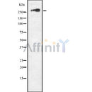 DF8681 staining HepG2 by IF/ICC. The sample were fixed with PFA and permeabilized in 0.1% Triton X-100,then blocked in 10% serum for 45 minutes at 25¡ãC. The primary antibody was diluted at 1/200 and incubated with the sample for 1 hour at 37¡ãC. An  Alexa Fluor 594 conjugated goat anti-rabbit IgG (H+L) Ab, diluted at 1/600, was used as the secondary antibod