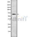 DF8684 staining Hela by IF/ICC. The sample were fixed with PFA and permeabilized in 0.1% Triton X-100,then blocked in 10% serum for 45 minutes at 25¡ãC. The primary antibody was diluted at 1/200 and incubated with the sample for 1 hour at 37¡ãC. An  Alexa Fluor 594 conjugated goat anti-rabbit IgG (H+L) Ab, diluted at 1/600, was used as the secondary antibod