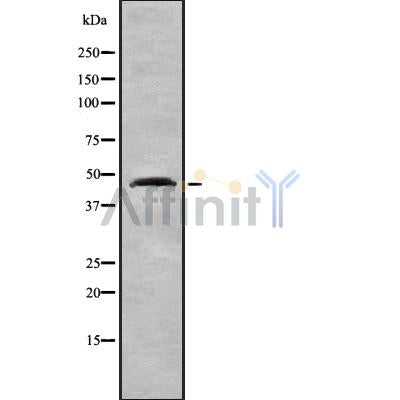 DF8685 staining Hela by IF/ICC. The sample were fixed with PFA and permeabilized in 0.1% Triton X-100,then blocked in 10% serum for 45 minutes at 25¡ãC. The primary antibody was diluted at 1/200 and incubated with the sample for 1 hour at 37¡ãC. An  Alexa Fluor 594 conjugated goat anti-rabbit IgG (H+L) Ab, diluted at 1/600, was used as the secondary antibod
