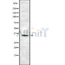 DF8686 staining HepG2 by IF/ICC. The sample were fixed with PFA and permeabilized in 0.1% Triton X-100,then blocked in 10% serum for 45 minutes at 25¡ãC. The primary antibody was diluted at 1/200 and incubated with the sample for 1 hour at 37¡ãC. An  Alexa Fluor 594 conjugated goat anti-rabbit IgG (H+L) Ab, diluted at 1/600, was used as the secondary antibod
