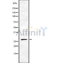 DF8687 staining COLO205 by IF/ICC. The sample were fixed with PFA and permeabilized in 0.1% Triton X-100,then blocked in 10% serum for 45 minutes at 25¡ãC. The primary antibody was diluted at 1/200 and incubated with the sample for 1 hour at 37¡ãC. An  Alexa Fluor 594 conjugated goat anti-rabbit IgG (H+L) Ab, diluted at 1/600, was used as the secondary antibod