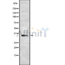DF8688 staining Hela by IF/ICC. The sample were fixed with PFA and permeabilized in 0.1% Triton X-100,then blocked in 10% serum for 45 minutes at 25¡ãC. The primary antibody was diluted at 1/200 and incubated with the sample for 1 hour at 37¡ãC. An  Alexa Fluor 594 conjugated goat anti-rabbit IgG (H+L) Ab, diluted at 1/600, was used as the secondary antibod