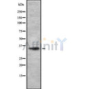 DF8689 staining HeLa by IF/ICC. The sample were fixed with PFA and permeabilized in 0.1% Triton X-100,then blocked in 10% serum for 45 minutes at 25¡ãC. The primary antibody was diluted at 1/200 and incubated with the sample for 1 hour at 37¡ãC. An  Alexa Fluor 594 conjugated goat anti-rabbit IgG (H+L) Ab, diluted at 1/600, was used as the secondary antibod