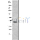 Western blot analysis of extracts from rat brain, using OR2A25 Antibody. Lane 1 was treated with the blocking peptide.
