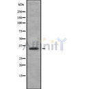 DF8691 staining Hela by IF/ICC. The sample were fixed with PFA and permeabilized in 0.1% Triton X-100,then blocked in 10% serum for 45 minutes at 25¡ãC. The primary antibody was diluted at 1/200 and incubated with the sample for 1 hour at 37¡ãC. An  Alexa Fluor 594 conjugated goat anti-rabbit IgG (H+L) Ab, diluted at 1/600, was used as the secondary antibod