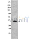 DF8693 staining Hela by IF/ICC. The sample were fixed with PFA and permeabilized in 0.1% Triton X-100,then blocked in 10% serum for 45 minutes at 25¡ãC. The primary antibody was diluted at 1/200 and incubated with the sample for 1 hour at 37¡ãC. An  Alexa Fluor 594 conjugated goat anti-rabbit IgG (H+L) Ab, diluted at 1/600, was used as the secondary antibod