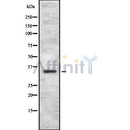 DF8695 staining Hela by IF/ICC. The sample were fixed with PFA and permeabilized in 0.1% Triton X-100,then blocked in 10% serum for 45 minutes at 25¡ãC. The primary antibody was diluted at 1/200 and incubated with the sample for 1 hour at 37¡ãC. An  Alexa Fluor 594 conjugated goat anti-rabbit IgG (H+L) Ab, diluted at 1/600, was used as the secondary antibod