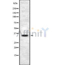 DF8697 staining HeLa by IF/ICC. The sample were fixed with PFA and permeabilized in 0.1% Triton X-100,then blocked in 10% serum for 45 minutes at 25¡ãC. The primary antibody was diluted at 1/200 and incubated with the sample for 1 hour at 37¡ãC. An  Alexa Fluor 594 conjugated goat anti-rabbit IgG (H+L) Ab, diluted at 1/600, was used as the secondary antibod