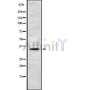 DF8699 staining HeLa by IF/ICC. The sample were fixed with PFA and permeabilized in 0.1% Triton X-100,then blocked in 10% serum for 45 minutes at 25¡ãC. The primary antibody was diluted at 1/200 and incubated with the sample for 1 hour at 37¡ãC. An  Alexa Fluor 594 conjugated goat anti-rabbit IgG (H+L) Ab, diluted at 1/600, was used as the secondary antibod