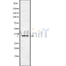 DF8700 staining HeLa by IF/ICC. The sample were fixed with PFA and permeabilized in 0.1% Triton X-100,then blocked in 10% serum for 45 minutes at 25¡ãC. The primary antibody was diluted at 1/200 and incubated with the sample for 1 hour at 37¡ãC. An  Alexa Fluor 594 conjugated goat anti-rabbit IgG (H+L) Ab, diluted at 1/600, was used as the secondary antibod